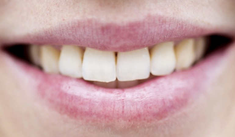 Zähne: Harte Kerle brauchen Pflege